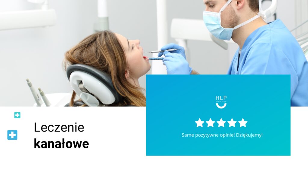 Leczenie kanałowe – czego się spodziewać krok po kroku